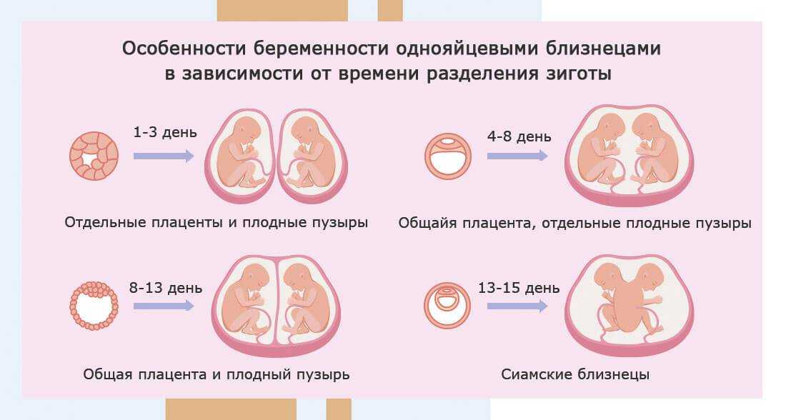 К чему снится беременность? сонник - беременность во сне 11 различных сонников и другие толкования