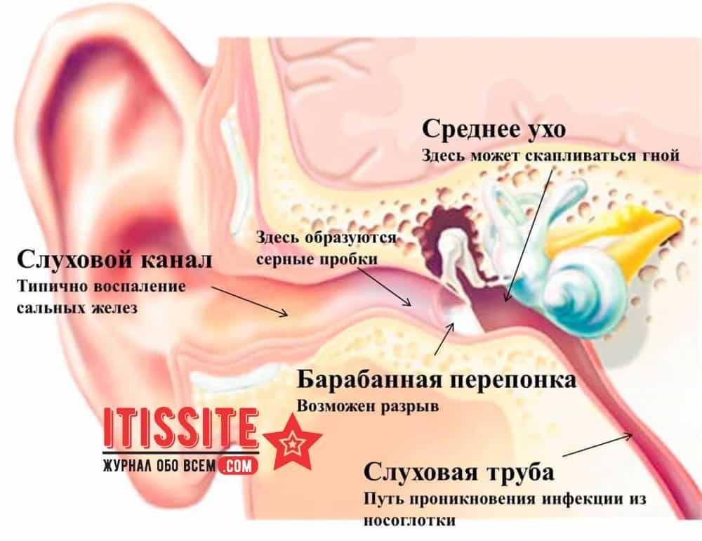 Шум в ушах (шум в голове)
