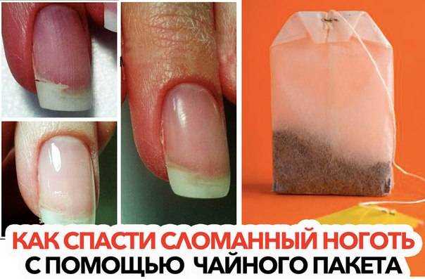 Сломался ноготь: приметы для всех пальцев левой и правой руки
