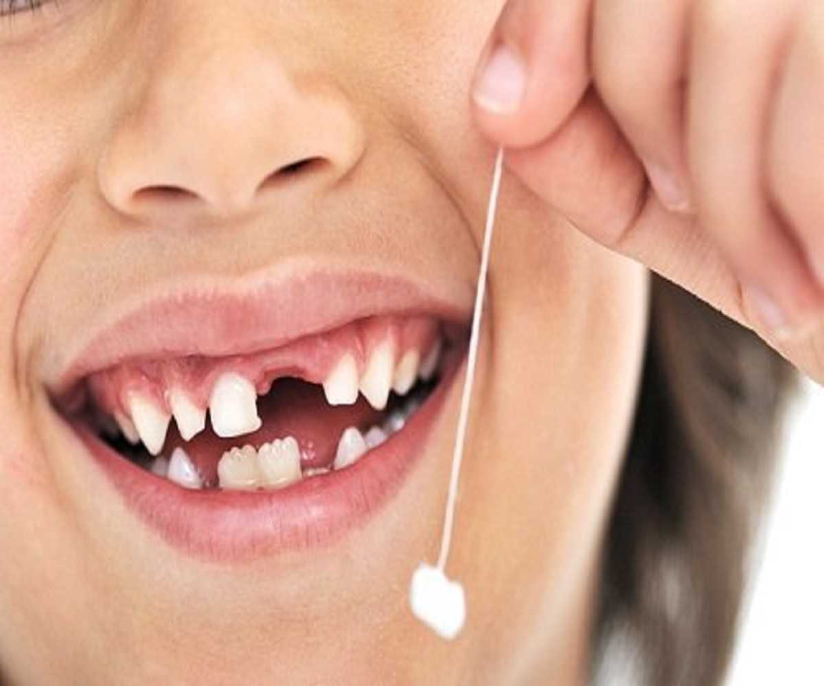 Сонник выпадение зубов без