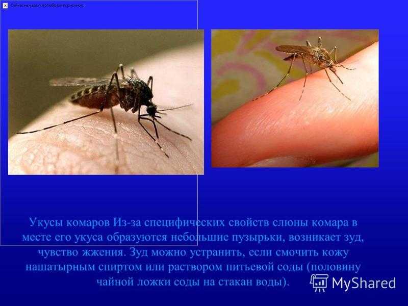Почему укус комара. Укусы кровососущих насекомых. Укусы насекомых симптомы.