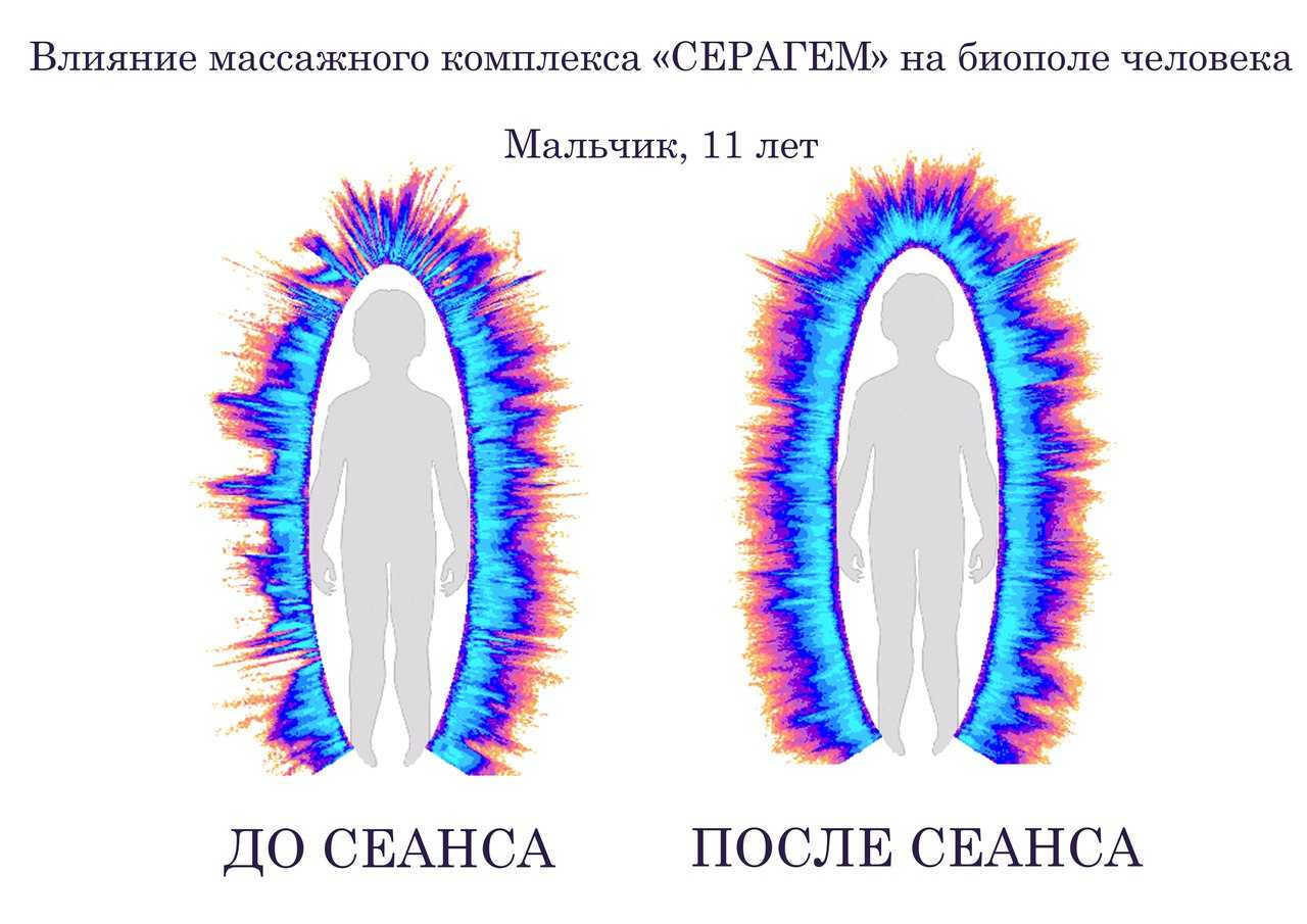 Аура человека цвета. Биополе. Размер биополя человека. Биополе человека фото. Гурвич биополе.