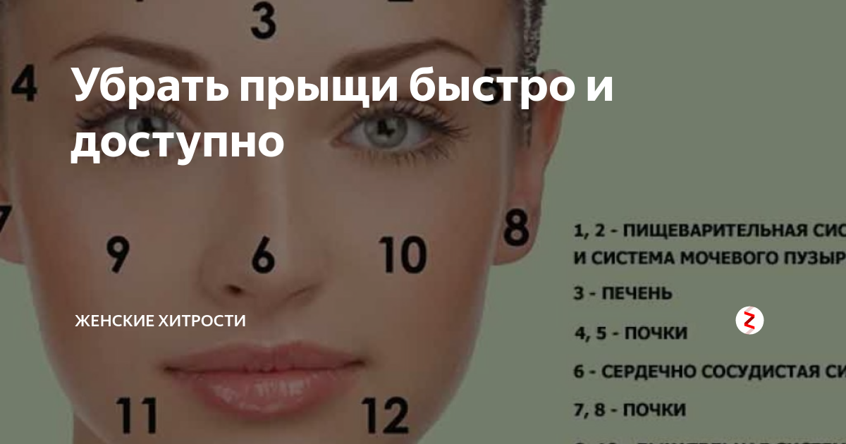 Приметы о прыщах на лбу – что означает их появление для девушек и парней