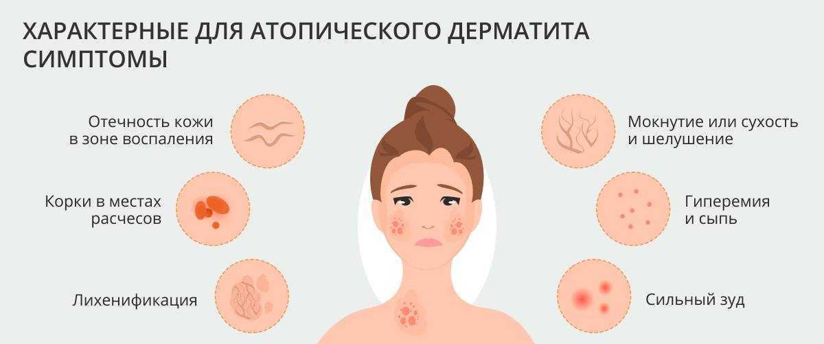 Просянка (белые угри, милиумы) – причины появления, лечение, профилактика