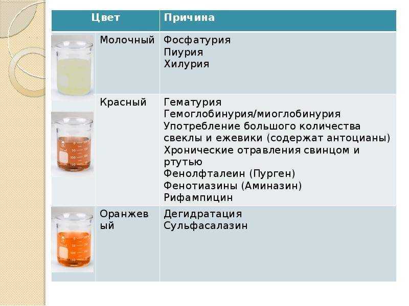 Соли кислой мочи фото