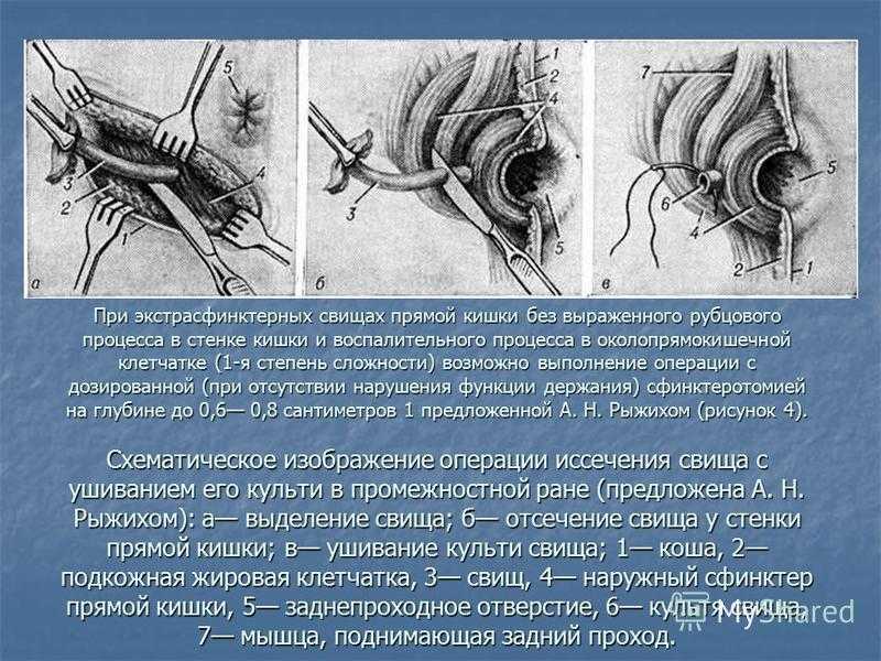 Сонник гной выходит наружу к чему снится гной выходит наружу во сне