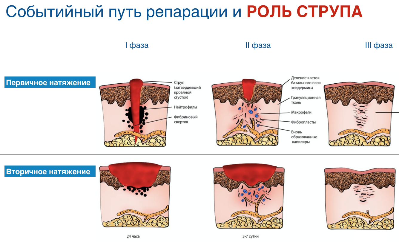 Плотный открыться