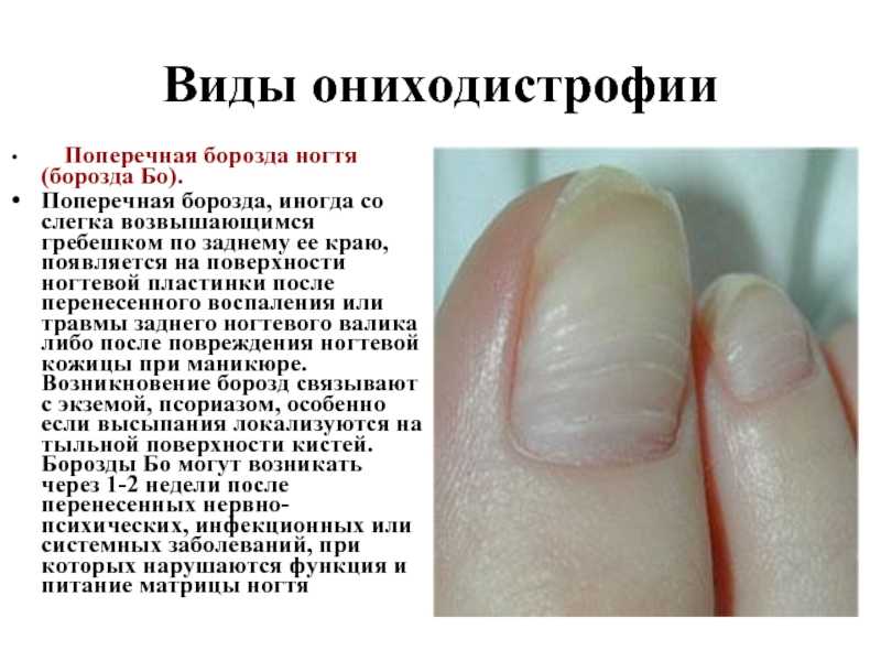 Почему появляются радужные круги перед глазами? «ochkov.net»