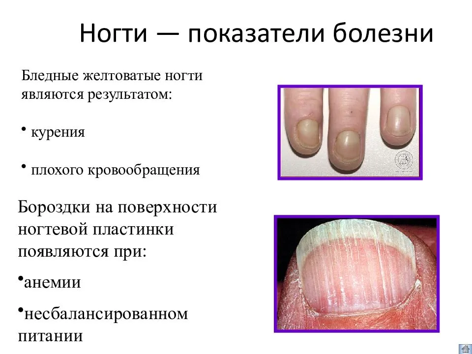 Не просто так появляются белые пятна на ногтях Приметы способны рассказать многое Даже мелкая деталь, случившаяся с вами, имеет скрытый смысл и несет определенную информацию