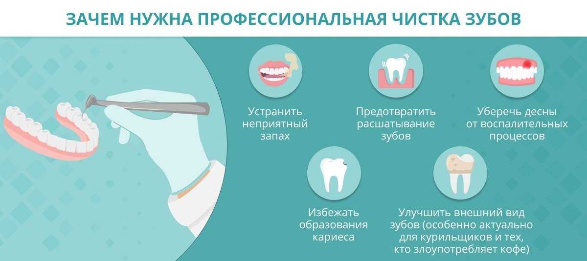 Во время уразы можно ли чистить зубы. Ультразвуковая чистка зубов схема. Чистка зубов ультразвуком. Рекомендации после чистки зубов. Гигиеническая чистка зубов.