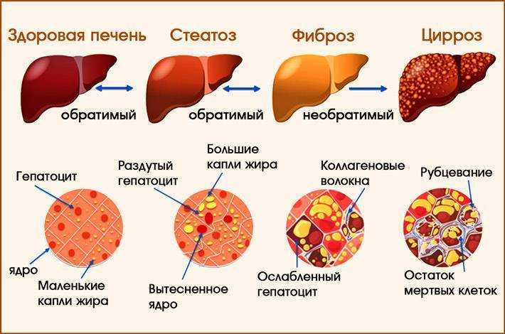 Урок 8: архетипы планет. прозерпина