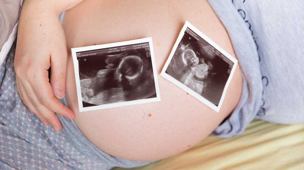 К чему снится, что ты беременная двойней: толкования сонников